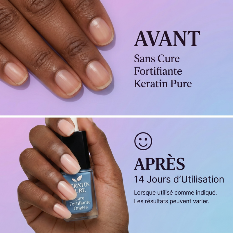 Gel Réparateur des Ongles SmartNails™ en 14 Jours + 1 Crème Mains en Cadeau 🎁