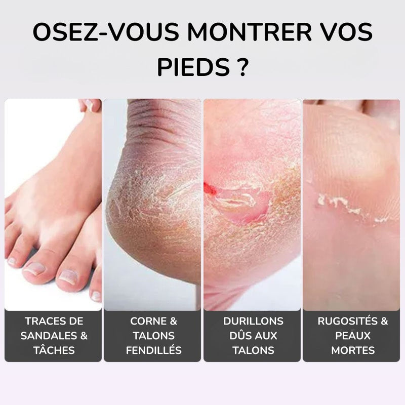 SmartPedicure™ - Cure Peeling "Pieds de Bébé" (Boîte Complète de 5 Paires)